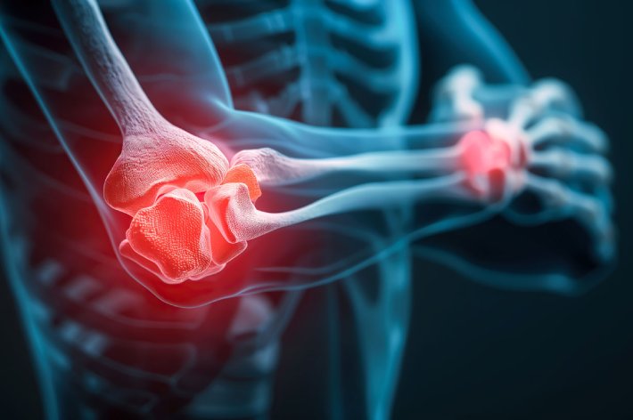 elbow-wrist-pain-doctor